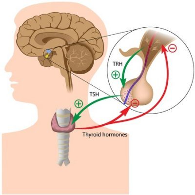 Varaṇādi Kvātha Bhāvita Śilājatu – An Effective Remedy in Primary Acquired Hypothyroidism